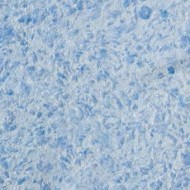 Виктория 717 жидкие обои (3,5-4 м2/кг) Виктория 717 жидкие обои (3,5-4 м2/кг)